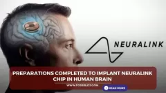 Preparations completed to implant Neuralink Picture