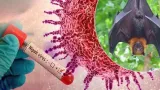 What Is Nipah Virus, Its Symptoms, and WHO Statement on India Cases