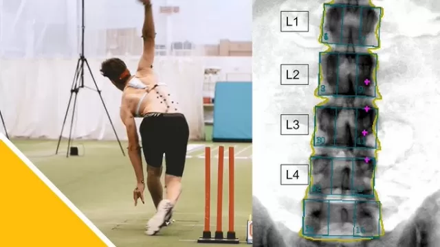 lower back injury cricket