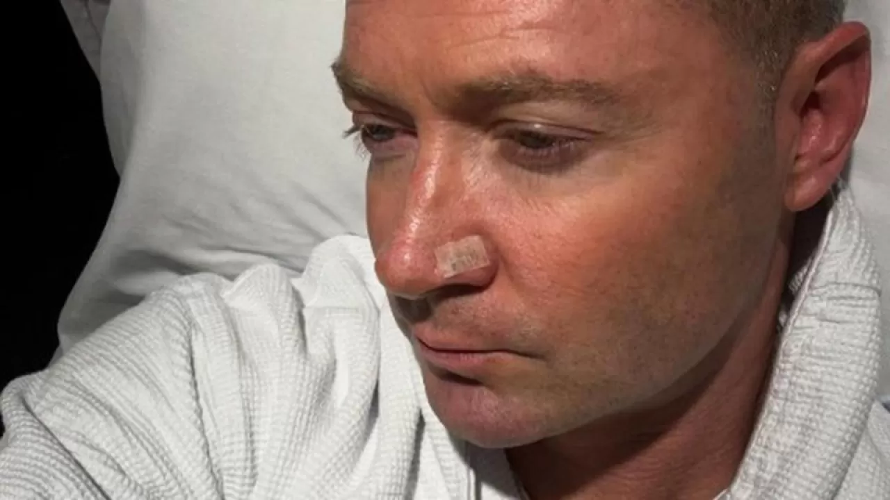 michael clarke skin cancer surgery