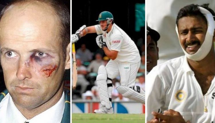 MOST COMMON CRICKET INJURIES