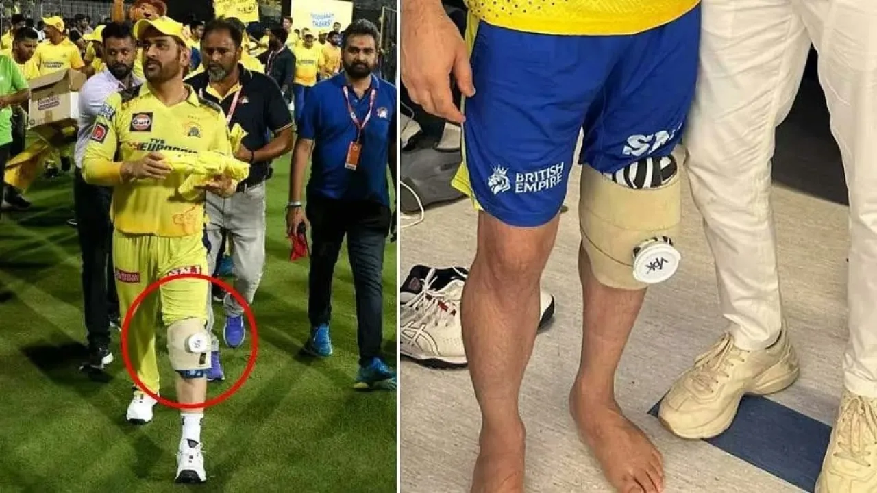 ms dhoni injury update ipl 2026 srh vs csk